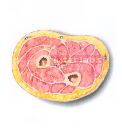 HUMAN TRANSVERSE SECTION MODEL THROUGH THE PORXIMAL 1/3 OF RIGHT FOREARM (A)